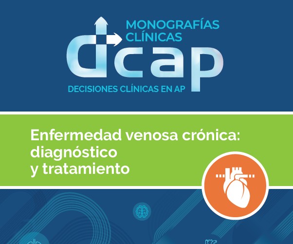 DCAP. Decisiones en la consulta de AP: Enfermedad venosa crónica: diagnóstico y tratamiento 